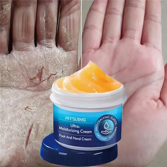 Revitalize Your Skin: Anti-Drying Crack Hand & Foot Cream!