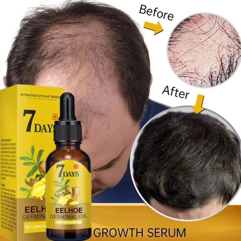Fast Hair Growth Serum Ginger Natural Anti Hair Loss Regrowth Essential Oil For Men Baldhead Repair Women Damaged Hair Root Care