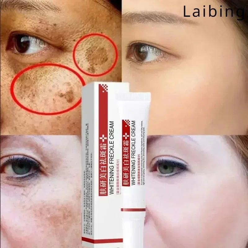 Whitening Freckle Cream Remove Melasma Melanin Faded Spots Dark Yellow Brightening Moisturizing Face Whitening Cream for Women