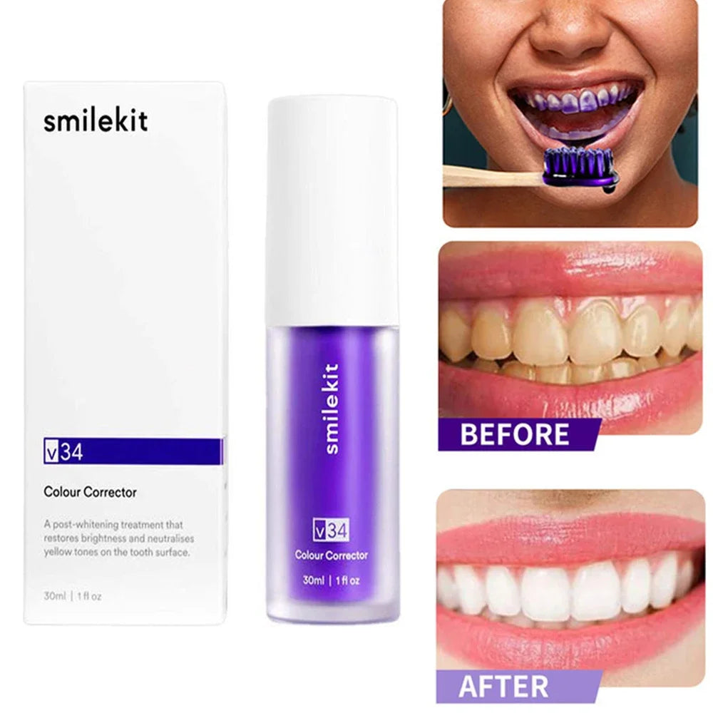 V34 30ml SMILEKIT - Your Ultimate Teeth Whitening Solution!