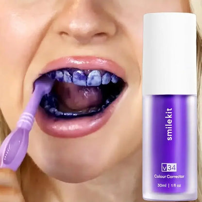 V34 30ml SMILEKIT - Your Ultimate Teeth Whitening Solution!