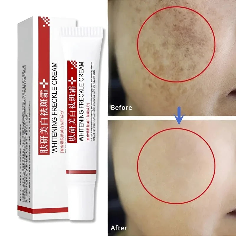 Whitening Freckle Cream for Women